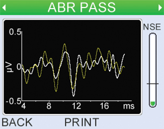 ABR Test waveform